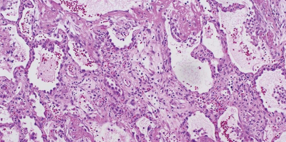 Cientistas anunciam a descoberta de um novo órgão do corpo humano, o interstício