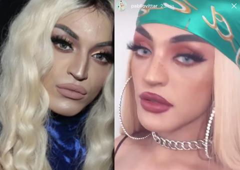  Pabllo Vittar mostra resultado de cirurgia no nariz; veja antes e depois
