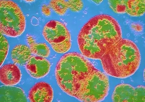 Supergonorreia resistente a antibióticos tem primeiro caso confirmado