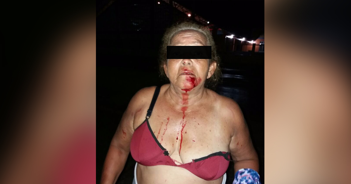 Idosa é espancada em Carauari e família acusa polícia de omissão