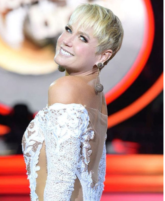 No hospital, Xuxa lamenta por sofrer acidente; Veja foto 