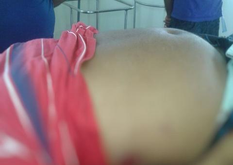 Por ciúmes, homem é assassinado com tiro de espingarda  no Amazonas 