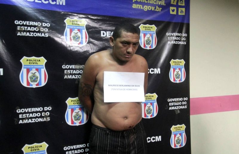 Homem dá enxadada em esposa que tem rosto desfigurado em Manaus