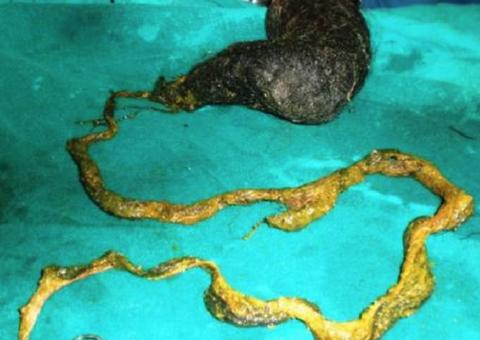 Criança dá entrada em hospital com dores no abdômen e motivo é assustador