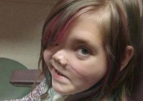 Menina que teve crânio partido ao meio descreve 'paraíso' após três anos em coma