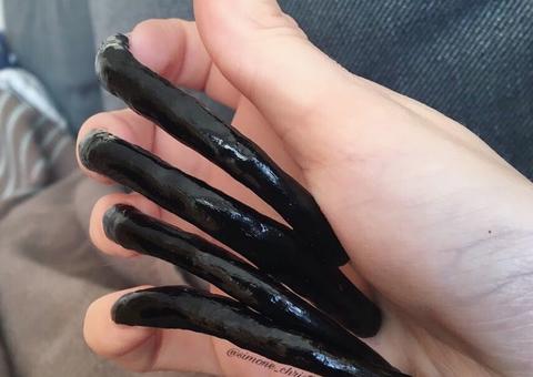 Jovem fica quatro anos sem cortar as unhas e resultado é chocante