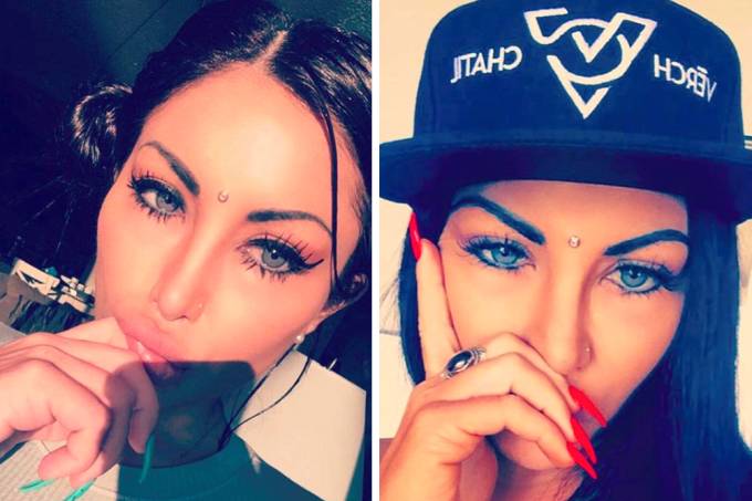 Modelo faz cirurgia para ficar com olhos claros e o pior acontece