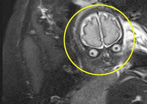 Pais levam susto ao ver ultrassom de bebê