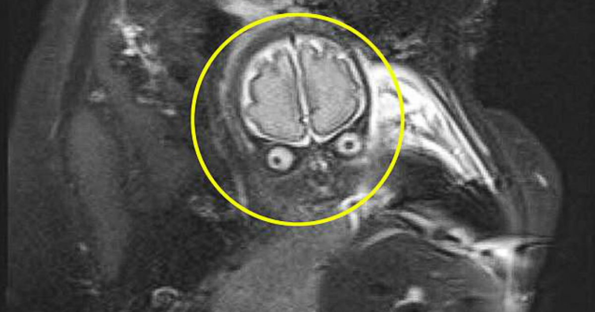 Pais levam susto ao ver ultrassom de bebê