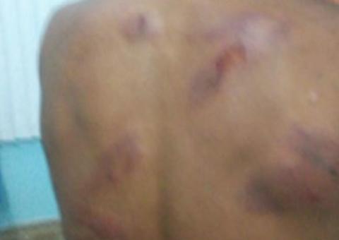 Trio é preso após espancar e torturar mulher em confusão por R$100 no Amazonas