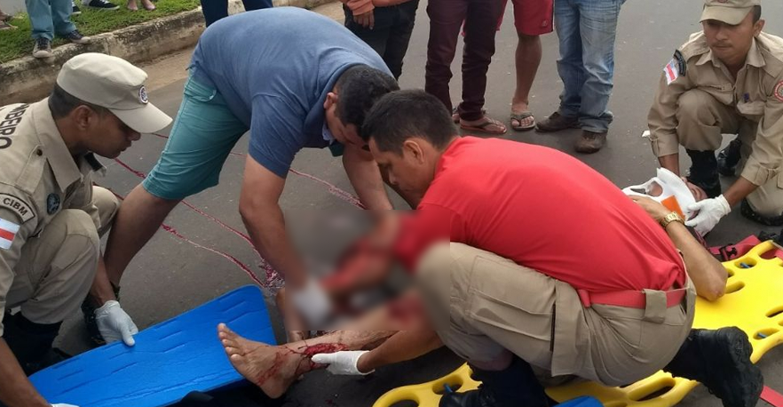 Homem fica com osso exposto em via pública após ser atropelado no Amazonas