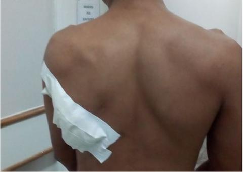 Homem é baleado na frente da filha dentro de lanchonete em Manaus 