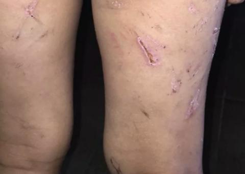 Mãe e padrasto são presos suspeitos de torturar menina de 4 anos