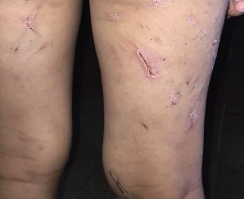 Mãe e padrasto são presos suspeitos de torturar menina de 4 anos