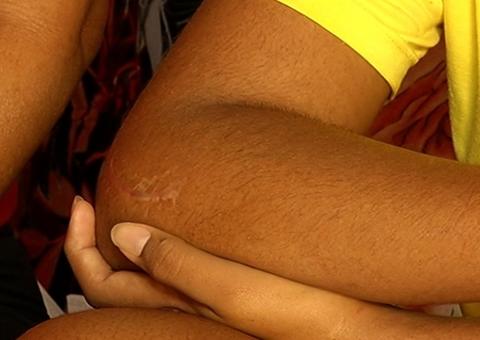 Estudante quebra os dois cotovelos após levar rasteira de colega em escola