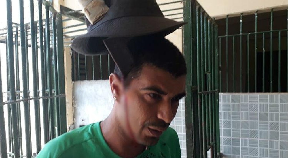 Homem tem peixeira cravada na cabeça durante briga em presídio