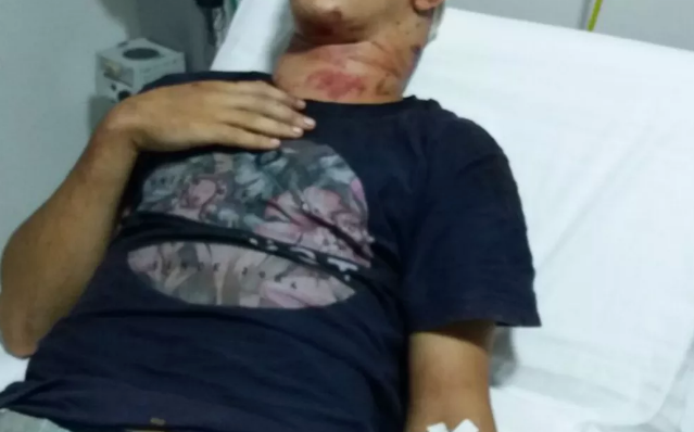 Dupla é presa após torturar adolescente durante assalto até ele se fingir de morto