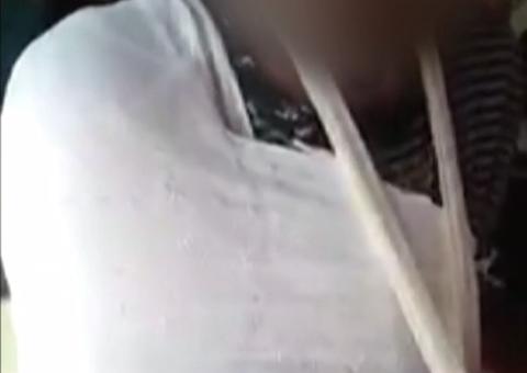 Idoso tem braço e tórax engessado por cima da roupa durante atendimento em UPA