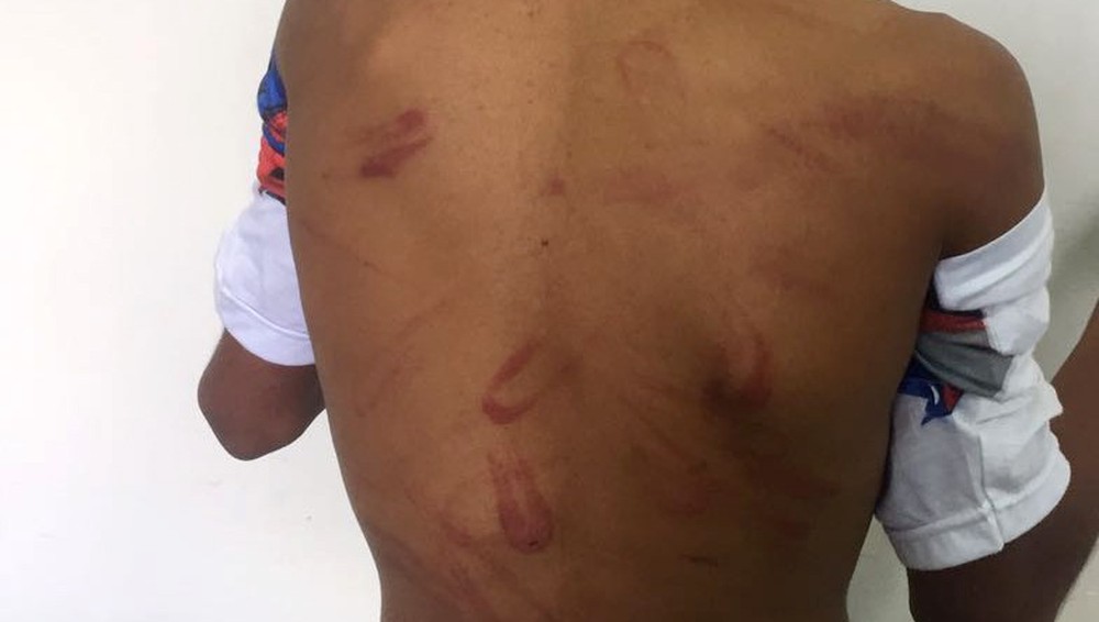 Mulher espanca sobrinho violentamente com fio elétrico e jovem tem atitude