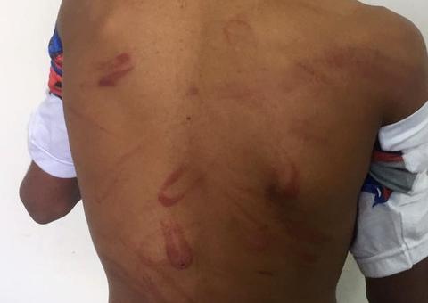 Mulher espanca sobrinho violentamente com fio elétrico e jovem tem atitude