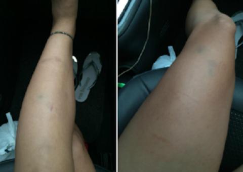  Motorista da Uber é acusado de espancar jovem para roubar celular durante corrida em Manaus