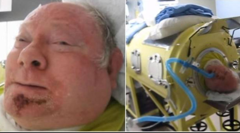 Homem está preso há 64 anos em uma máquina