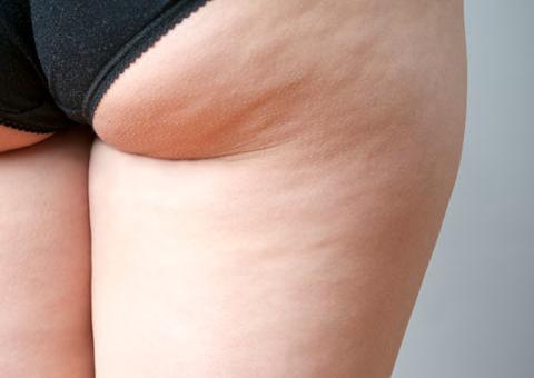 Tratamento de desintoxicação é opção para quem quer perder peso e acabar com celulites