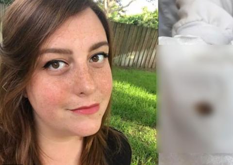 Mulher vive com algo estranho no ouvido durante nove dias