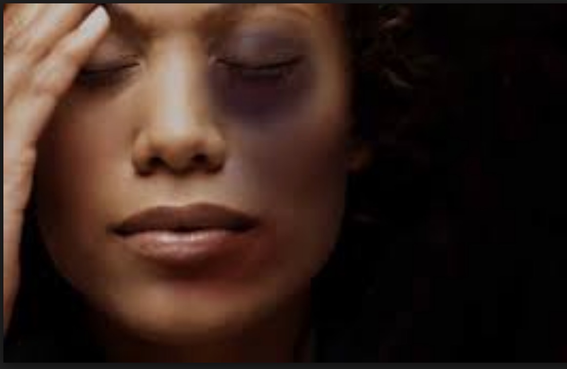 Polícia investiga suposta agressão de mãe de aluno a diretora da escola em Manaus 