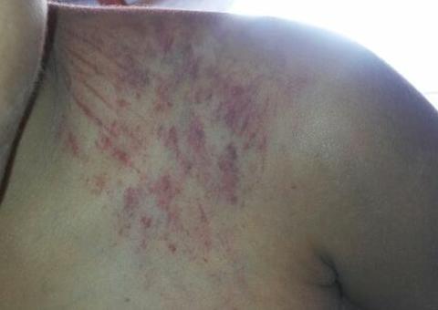 Mulher é presa suspeita de espancar enteado de 5 anos  