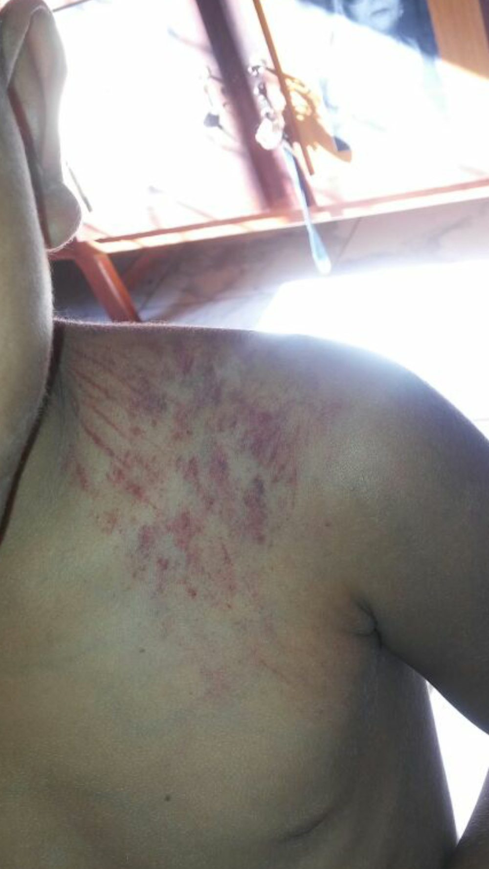 Mulher é presa suspeita de espancar enteado de 5 anos  