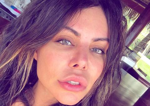 Modelo brasileira que processou Chris Brown está em coma na Turquia