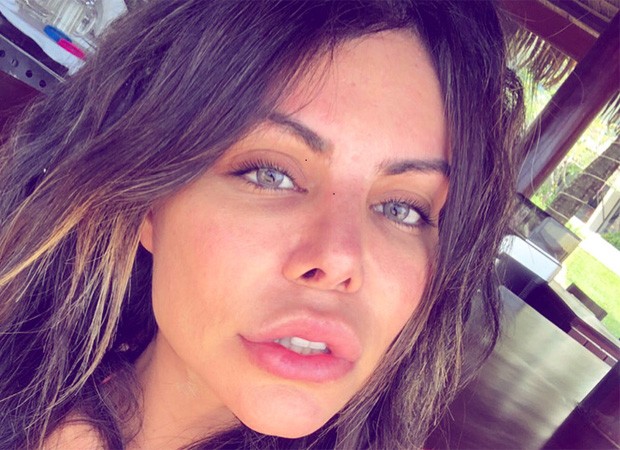 Modelo brasileira que processou Chris Brown está em coma na Turquia