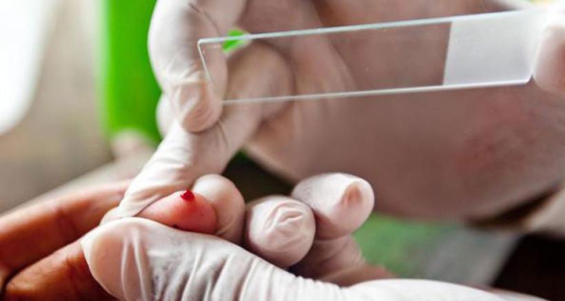 Município do Amazonas registra quase 9 mil casos de malária em 2018