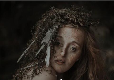 Jovem nasce com defeito facial extremamente raro, segue carreira de modelo