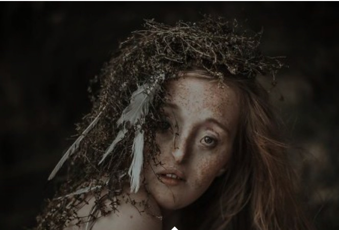 Jovem nasce com defeito facial extremamente raro, segue carreira de modelo