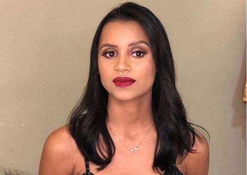 Ex-bbb Gleici muda detalhe no rosto e surge a cara da riqueza