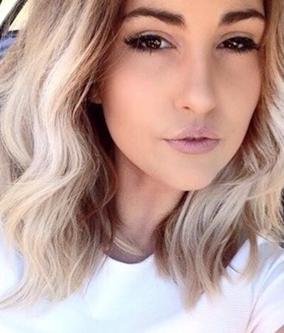 Modelo tem parte do rosto 'arrancada' ao ser atacada por cachorro