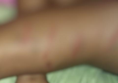 Adolescente é espancada pela mãe com taco de baseball por ir a lan house em Manaus