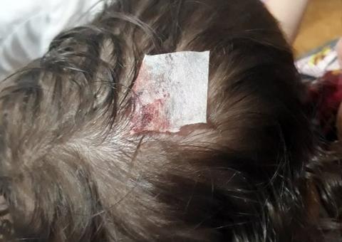  Parte de fachada de shopping cai e atinge criança de um ano 