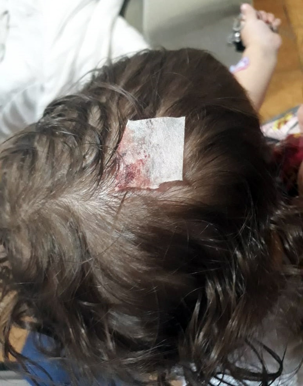  Parte de fachada de shopping cai e atinge criança de um ano 