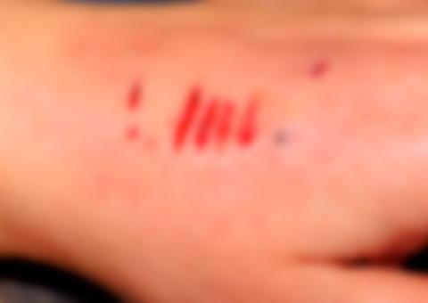 Para não perder desafio, jovem invade quadra de escola e morde 20 alunas