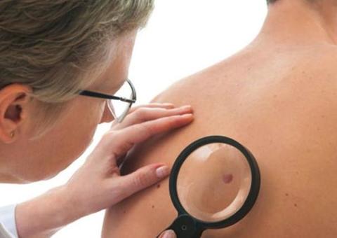 Fundação Alfredo da Matta oferta serviços dermatológicos em ação global neste sábado