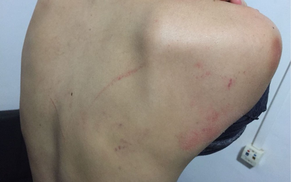  Ex-namorado é preso suspeito de espancar jovem em carro 