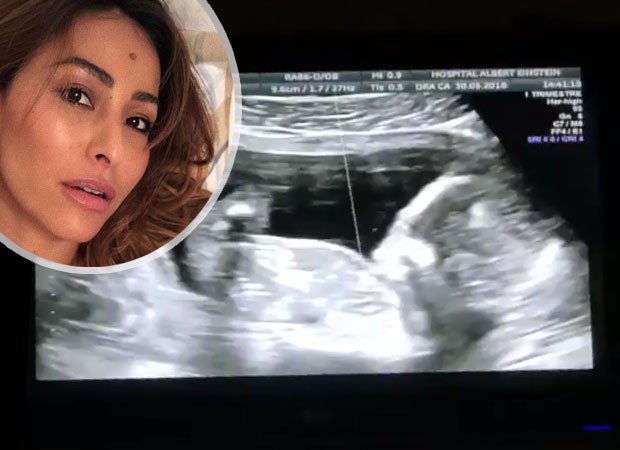 Sabrina Sato mostra ultrassom de bebê: 'matando a saudade'