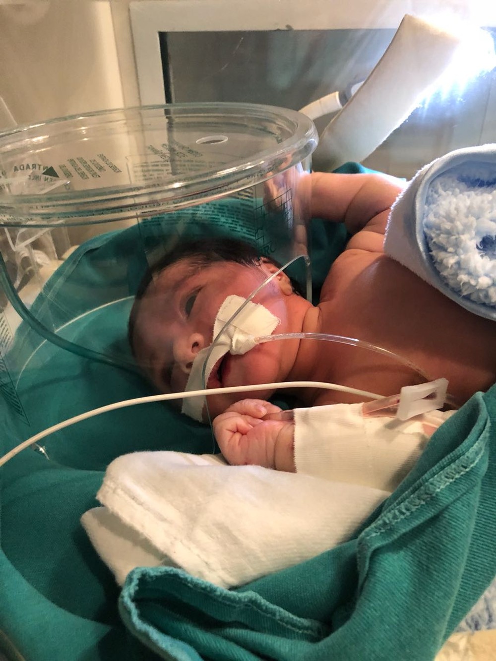 Bebê indígena enterrada viva está em estado grave, diz médico 