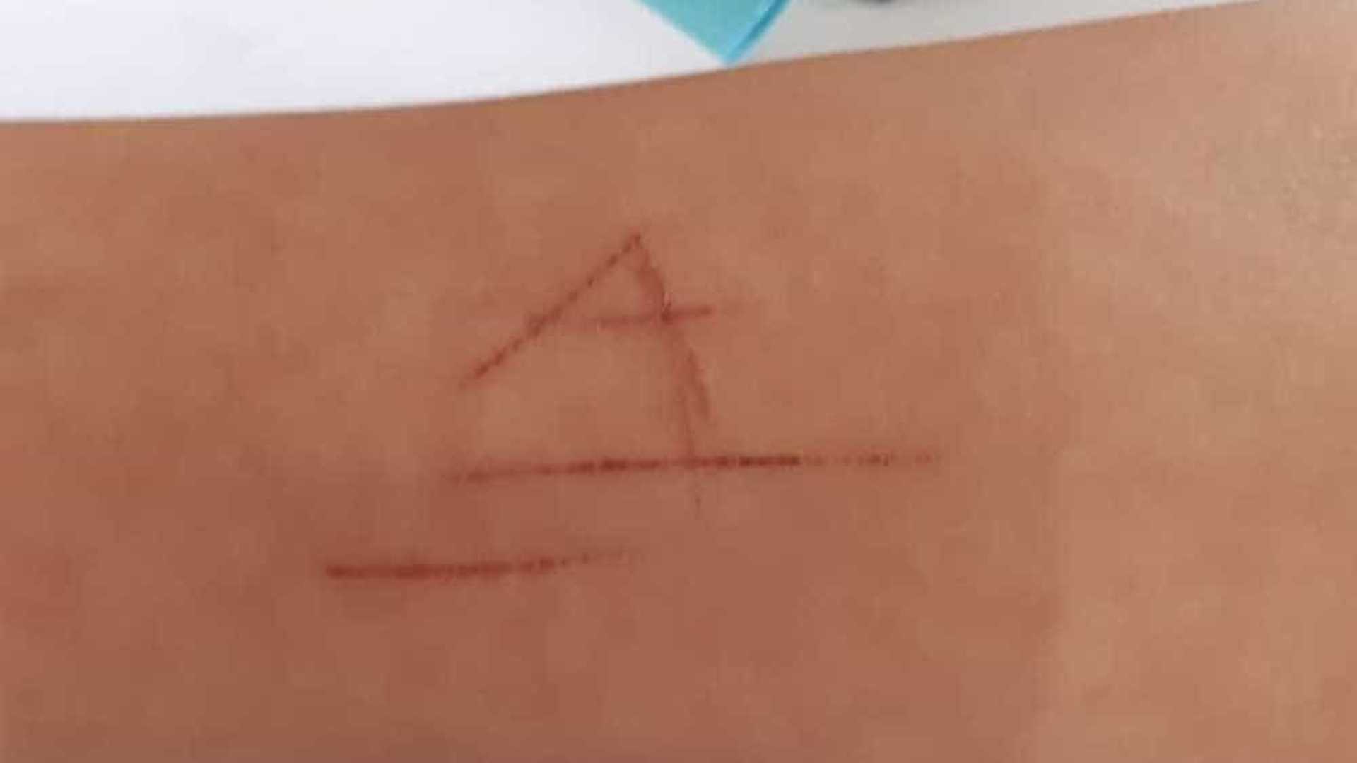 Após ser dopada, estudante é estuprada por encapuzados que deixam marca de tortura