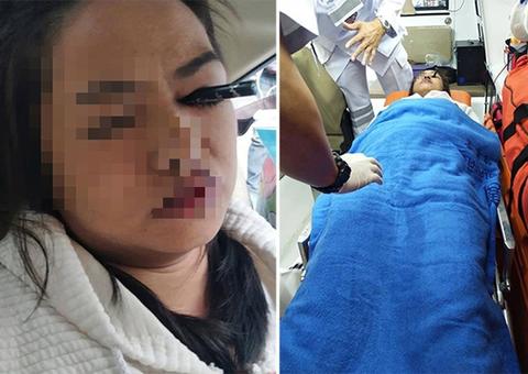 Após colisão, mulher que se maquiava em táxi crava delineador no olho