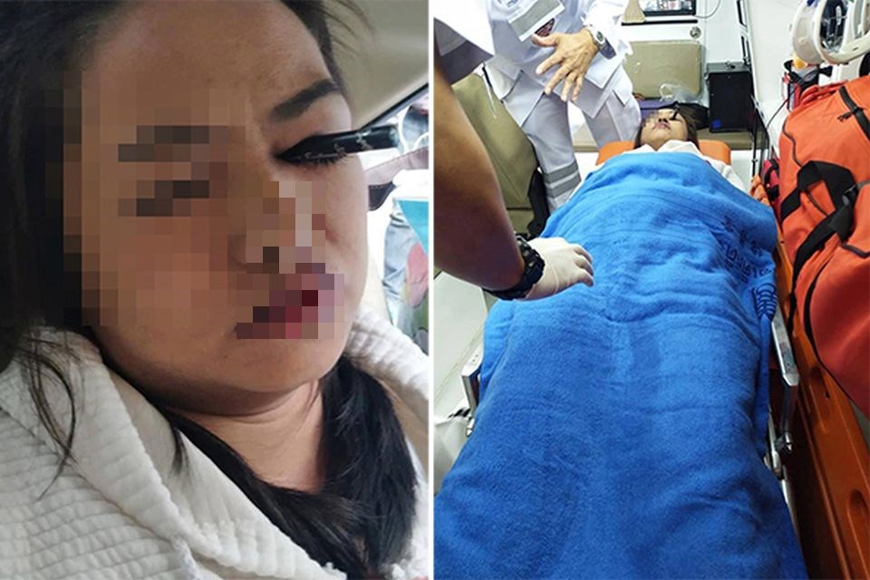 Após colisão, mulher que se maquiava em táxi crava delineador no olho