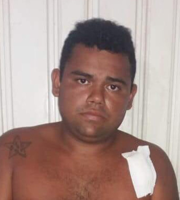 Após ser esfaqueado por vítima, suspeito de assalto é preso dentro de hospital no Amazonas